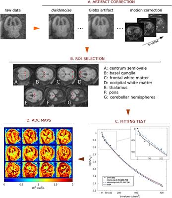 Apparent Diffusion Coefficient Assessment of Brain Development in Normal Fetuses and Ventriculomegaly